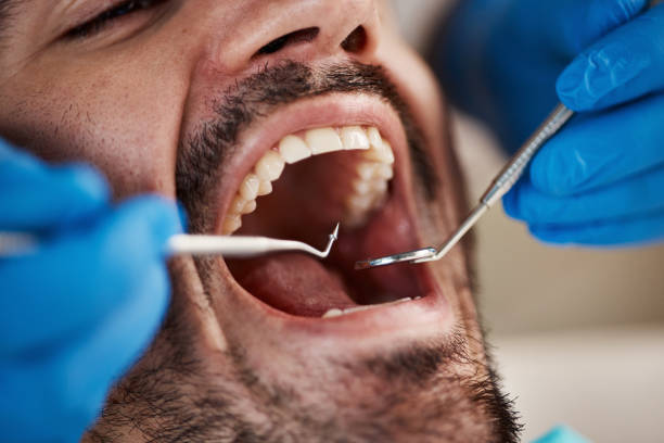 Best Emergency Dental Care for Trauma or Injury in Manteno, IL